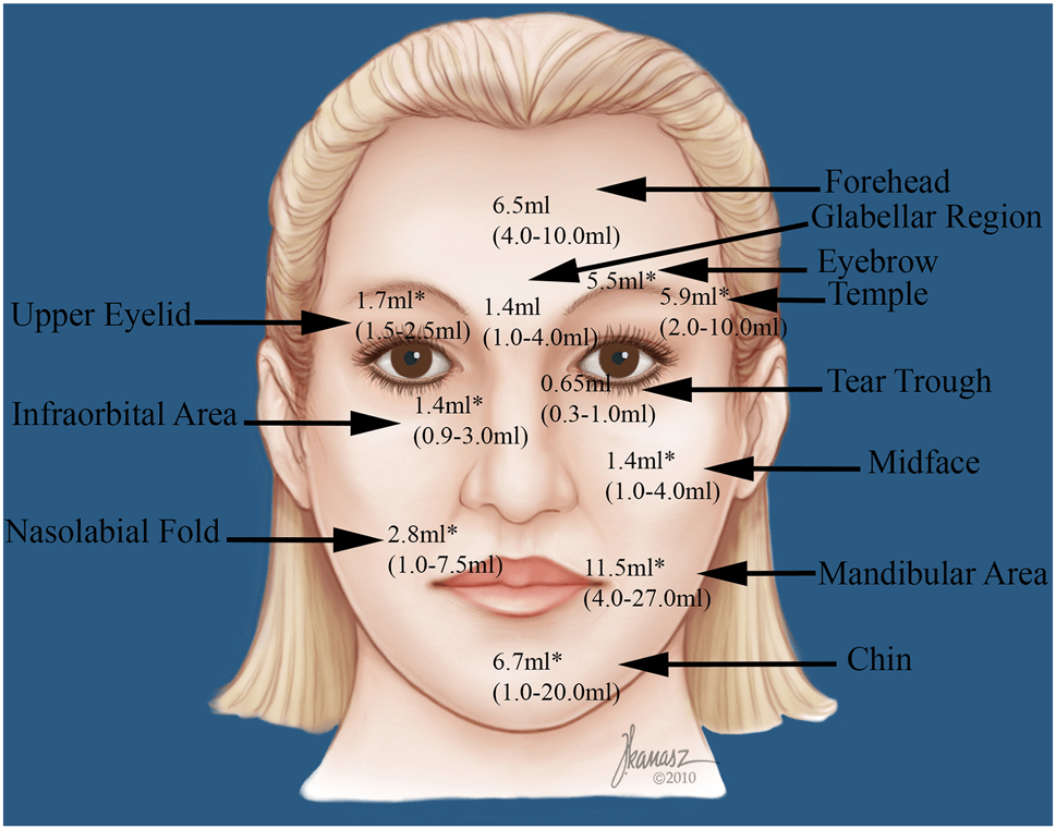 Fat Injection A Systematic Review of Injection Volumes by Facial Subunit