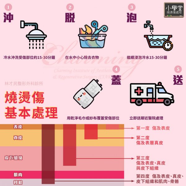【小學堂】燒燙傷基本處理 | 林才民整形外科診所CIARS