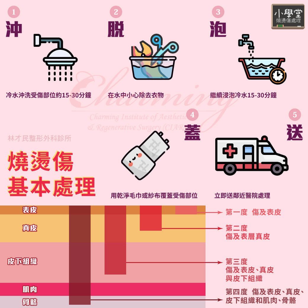 小學堂 燒燙傷基本處理 林才民整形外科診所ciars