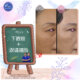 1. 下眼袋+補淚溝