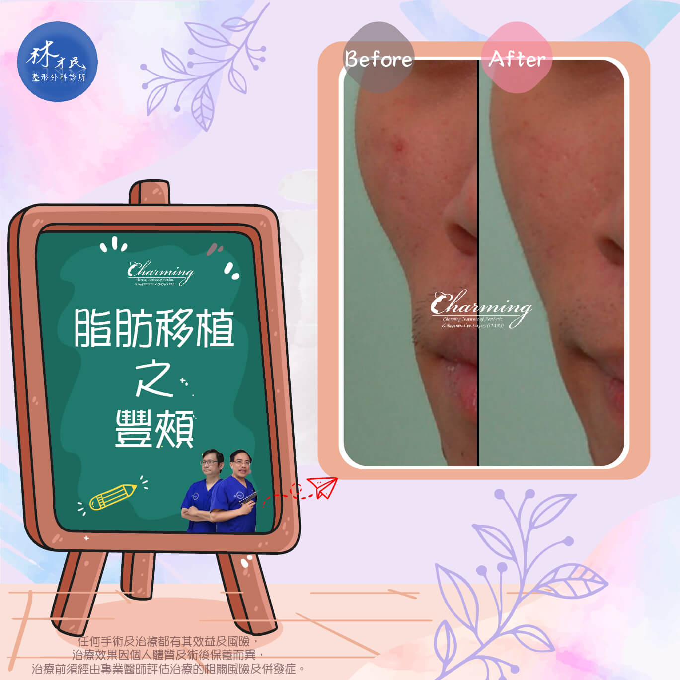6. 豐頰補脂