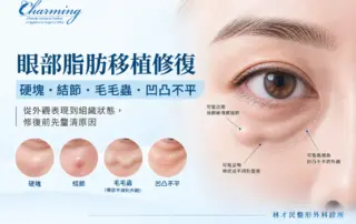 眼部脂肪移植修復示意圖，說明硬塊、結節、毛毛蟲與凹凸不平等眼下外觀問題