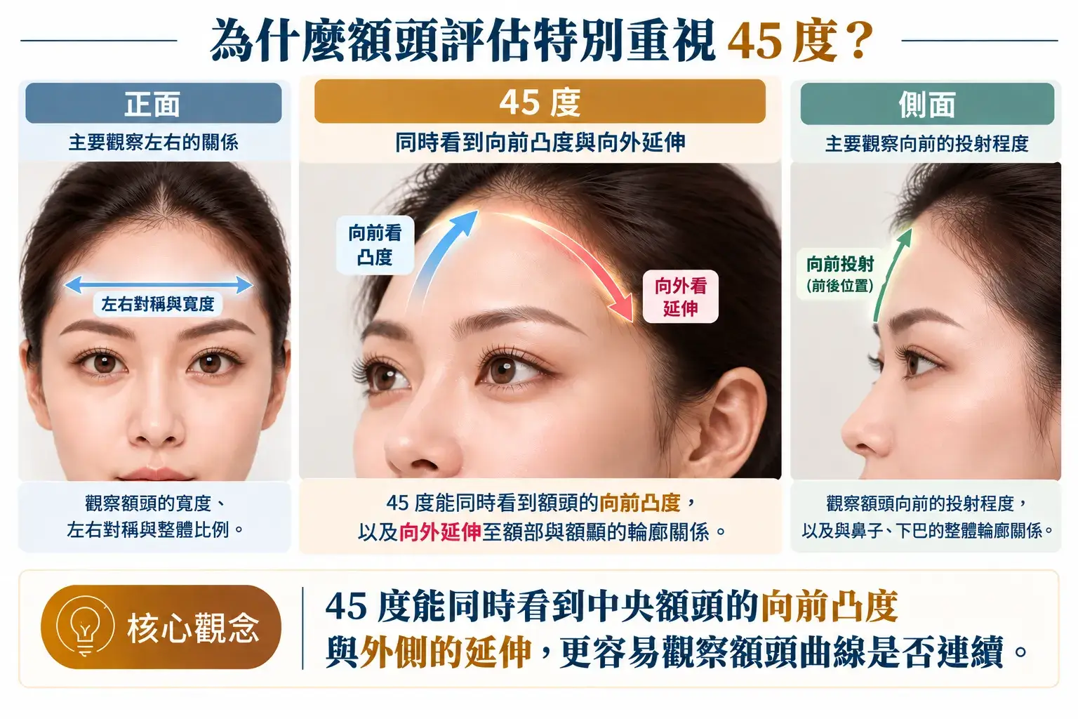 額頭脂肪移植三角度輪廓評估示意,正面觀察左右關係,側面觀察額頭向前的投射程度,45 度則可同時觀察中央額頭的向前凸度與外側延伸