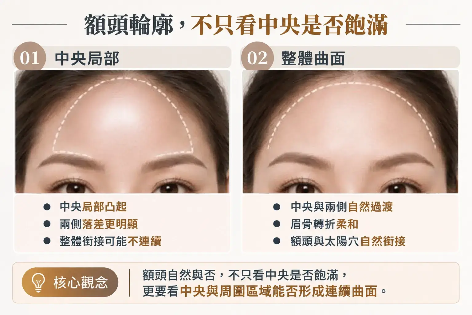 額頭脂肪移植輪廓比較,中央局部凸起可能使兩側落差更明顯;整體評估則著重中央、兩側、眉骨與太陽穴之間的自然銜接