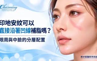 印地安紋補脂與眼周、中臉分層配置示意，女性臉部特寫以淡粉色半透明網格標示印地安紋沿顴部向外延伸的帶狀區域，呈現眼下至中臉的輪廓位置