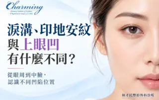 淚溝、印地安紋與上眼凹主題精選圖片，左側呈現眼周至中臉凹陷比較標題，右側為女性自然半臉特寫，清楚呈現上眼瞼、下眼與中臉輪廓