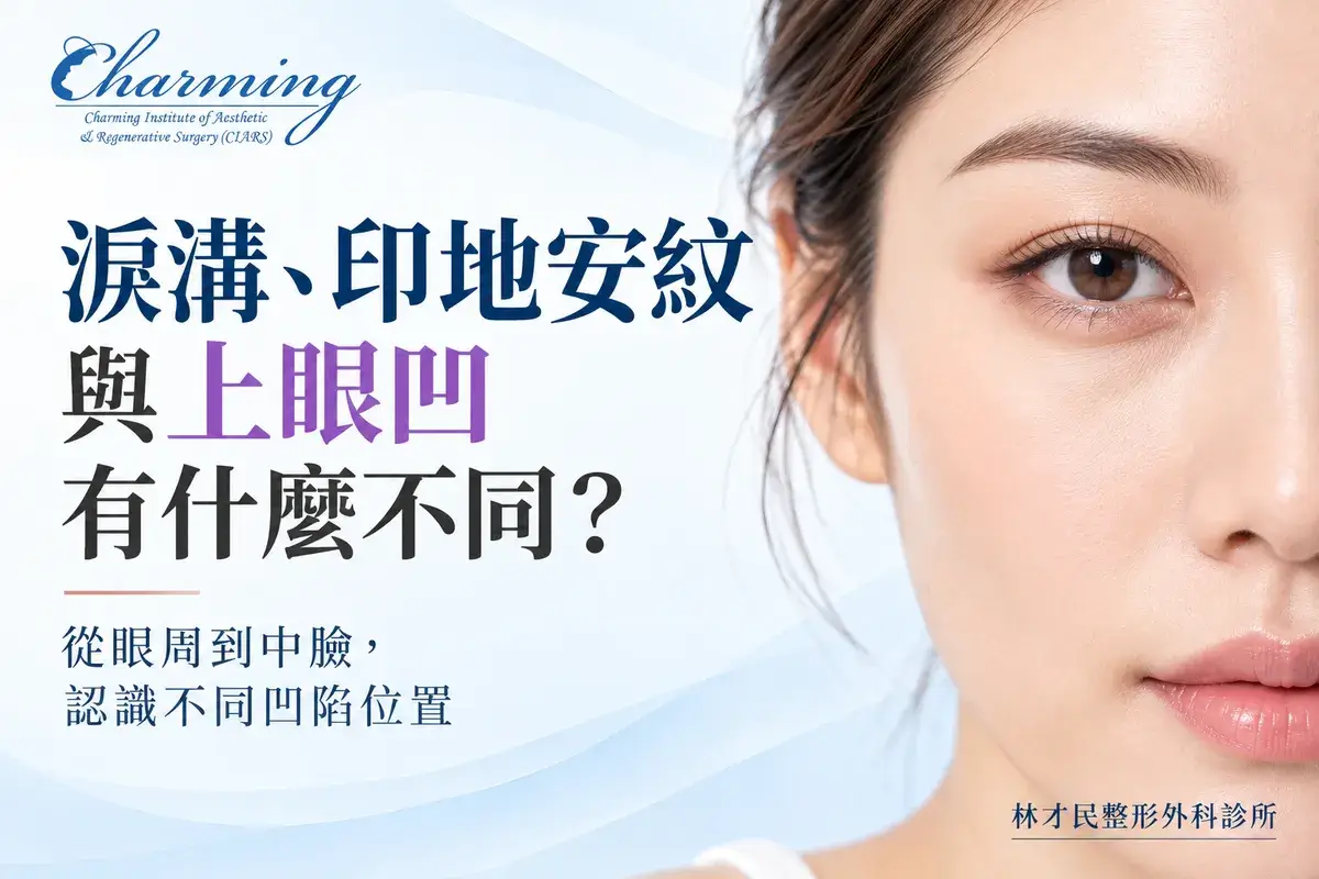 淚溝、印地安紋與上眼凹主題精選圖片，左側呈現眼周至中臉凹陷比較標題，右側為女性自然半臉特寫，清楚呈現上眼瞼、下眼與中臉輪廓